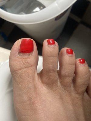 Cracked, Broken toenail