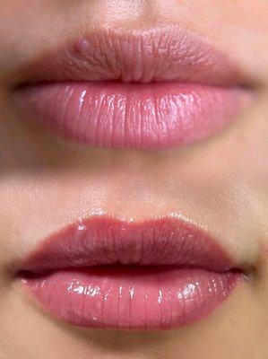 Before and bottom photo is healed lips after only one session of lip blush