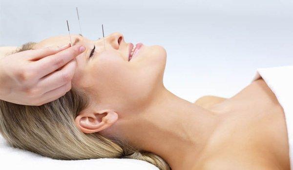 Facial Acupuncture for facial rejuvenation and wrinkle reduction