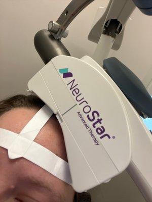 Nuerostar TMS Therapy