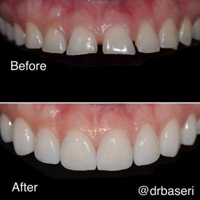 Cosmetic dentist, veneer dentist, emergency dentist, periodontist, best dentist, smile makeover