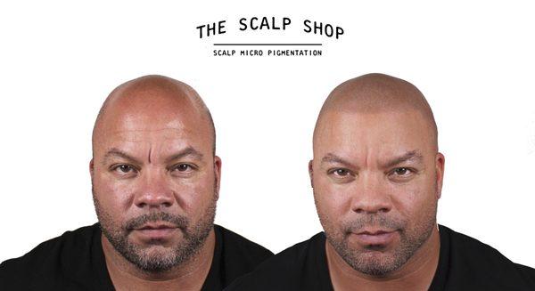 SMP Results from The Scalp Shop