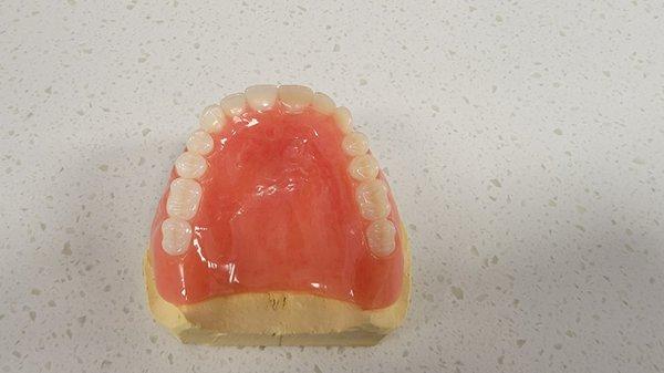 Ultra Premium Tier Upper Denture Esthetics