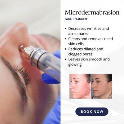 Microdermabrasion- classic, neat, affective!