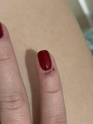 Cuts/Bruising from getting manicure