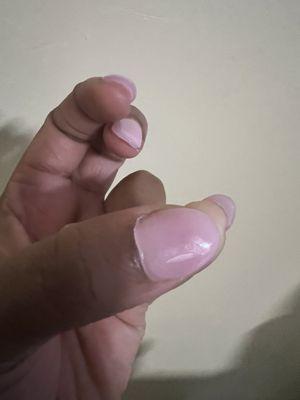 Acrylic under my nails. Thick nails. Good luck peeling stickers and picking up change or doing anything that requires fine motor.