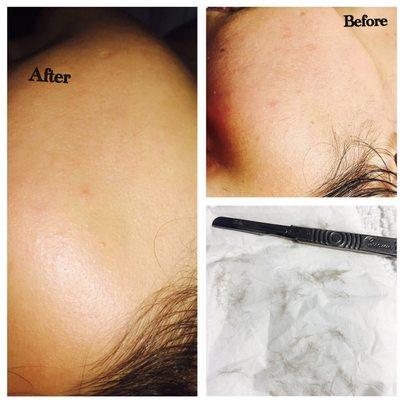 Dermaplaning , The new way to exfoliate your face. Book your appointment and spread the world about your experience.