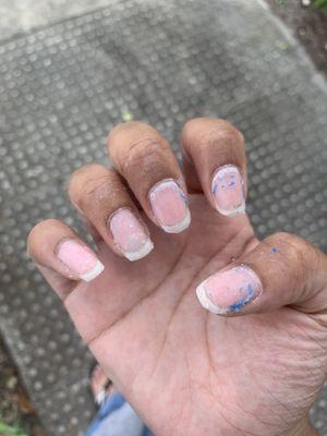 Nails after being "removed"