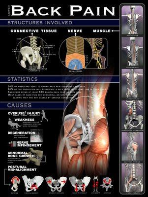 Back pain, structures involved