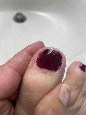 Pedicure worse than originally thought,  now that I can see it up close.