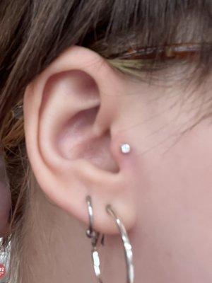 Tragus