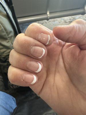 Chipped, peeling nails.