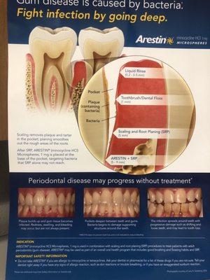 I don't have gum problems but every dentist gave u a spiel about deepcleaning, all I need is a new crown over an oldimplant,