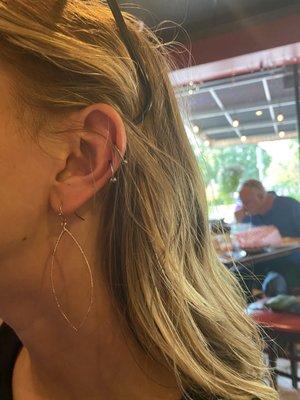 Double cartilage