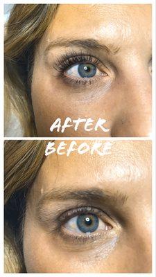 Lash lift lasts 6-10 weeks!