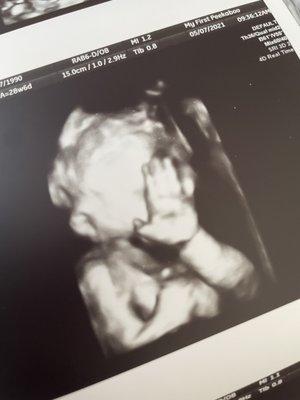 My First Peekaboo Ultrasound