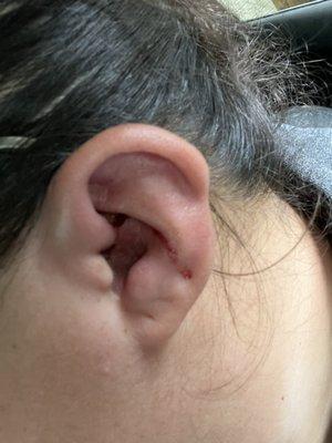 Left Ear Right after Removal