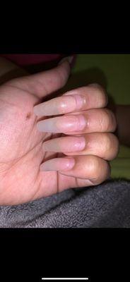 my nails a month later you can see lifting if you zoom in they were hanging by a thread.  picture doesn't do justice.