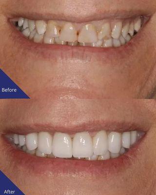 Premier Smiles & Implant Dentistry