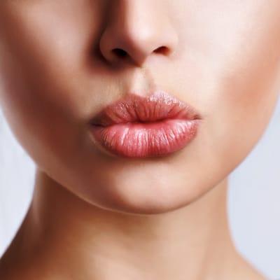 Lip Augmentation