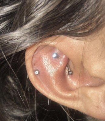 Correct jewelry for rook. Room for swelling.