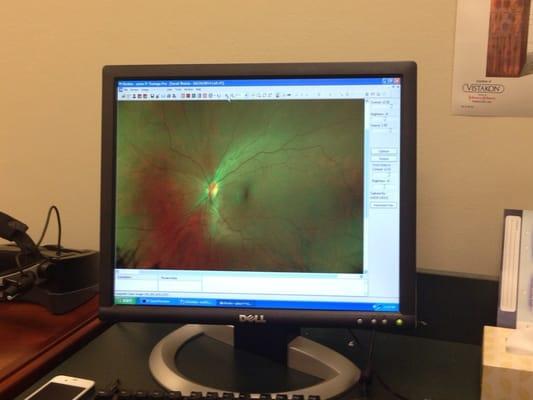 Check out how awesome my retina is!!!