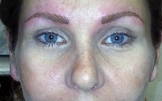 Newly done permanent eyebrows. Color will soften in about one week.