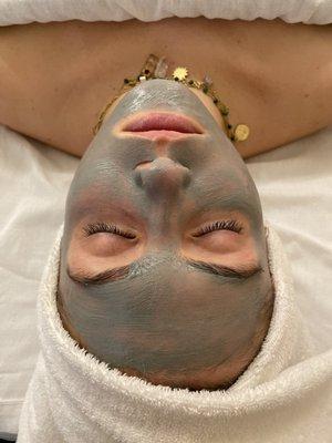 Acne Facial