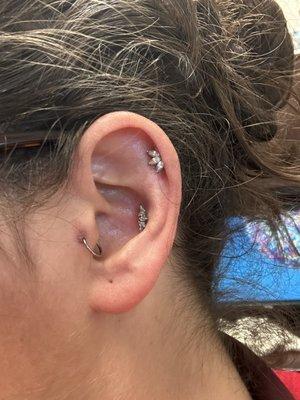 Fixed and healing tragus