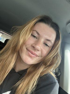 Immediately after my facial with zero makeup!!!!