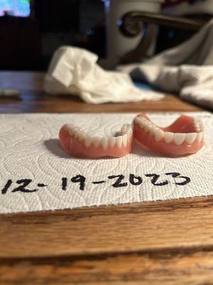 These are my husband's dentures. He's never ever been able to wear the bottom ones. It's been three years.