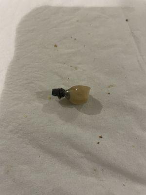 Failed implant done at Lone Hill Dental.