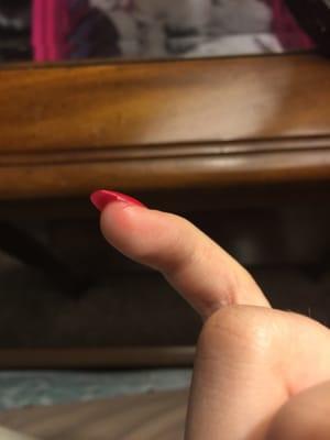 Deep cut on my pinky