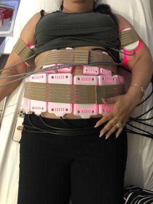 Laser lipo