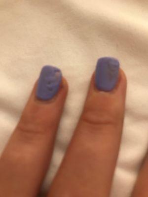 My bad nails