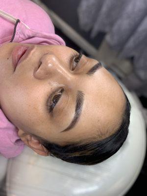 Microblading after initial treatment