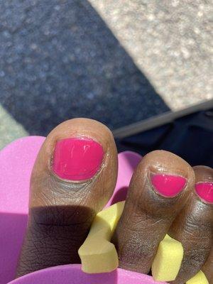 Poorly painted big toe