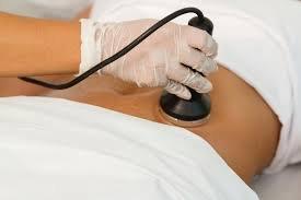 Radio Frequency Fat Removal  Treatments