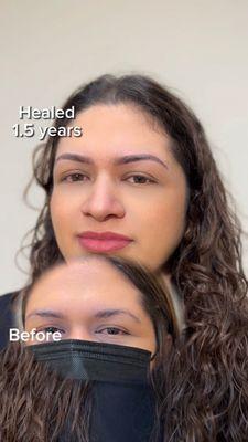 Best healed results