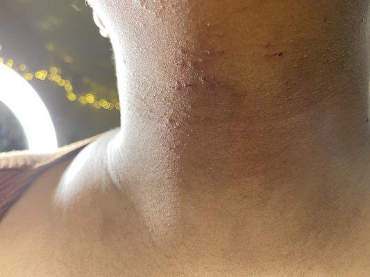 My neck after threading