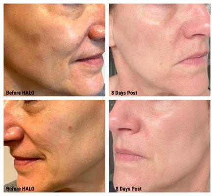 Amazing results from HALO