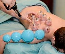 Cupping therapy is a great way to eliminate weakness in the body. Through this treatment, a person can recover from fatigue and weakness.