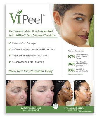 We offer the best peels