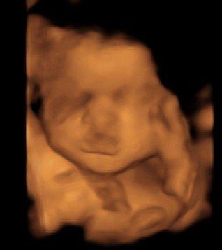 Bond Before Birth 3D/4D Ultrasound