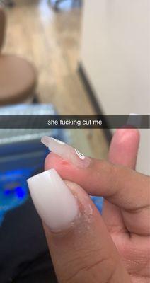 a cut on my finger