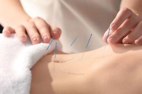 Acupuncture for any ailment you have.