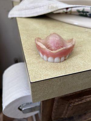 Dentures made by dentures by design if you have had your dentures made by these guys, please call MCNA DENTAL