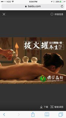 Cupping massage