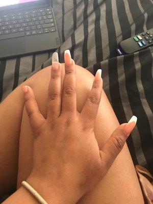 Broken nails