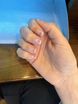 Ask for Gel-X removal and finished with clear polish. Gel isn't even fully removed and my nails are showing major trauma.